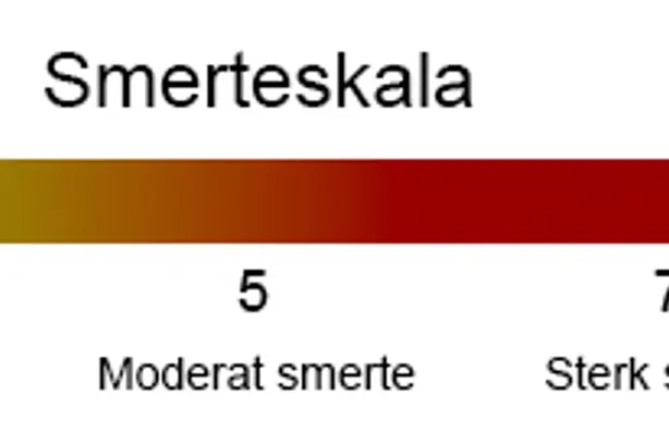 Smerteskala. 0, ingen smerte. 3, mild smerte. 5, moderat smerte. 10, verst tenkelig smerte.